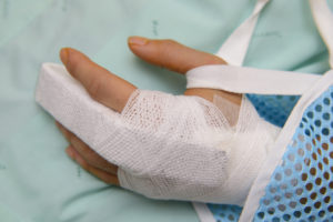 Broken Finger - Fracture Treatments and Recovery | Pembroke Pines - Miami FL